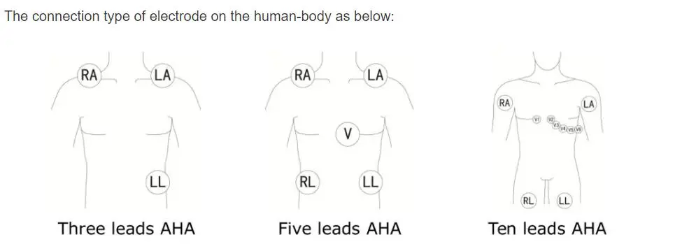5vodičové vodiče EKG pro philips digitrak plus 24hodinový holter 3100A, 5vodič, Snap